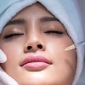 Which is Stronger: Dysport or Botox?