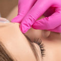 What Causes Dysport-Related Headaches?