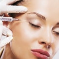 Are Dysport Touch-Ups Free?